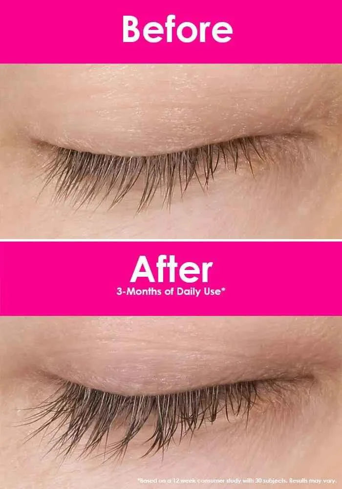 Close-up of upper eyelid and eyelashes shown in two panels