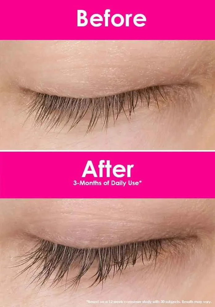 Close-up of upper eyelid and eyelashes shown in two panels