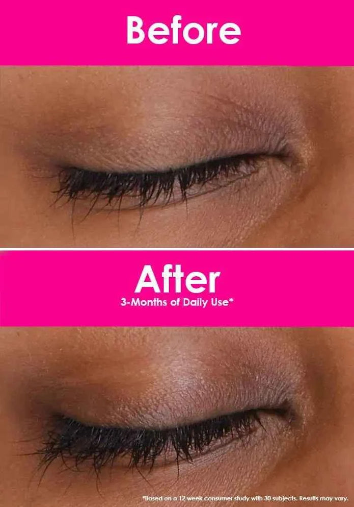 Close-up of closed eye and eyelashes shown in two panels