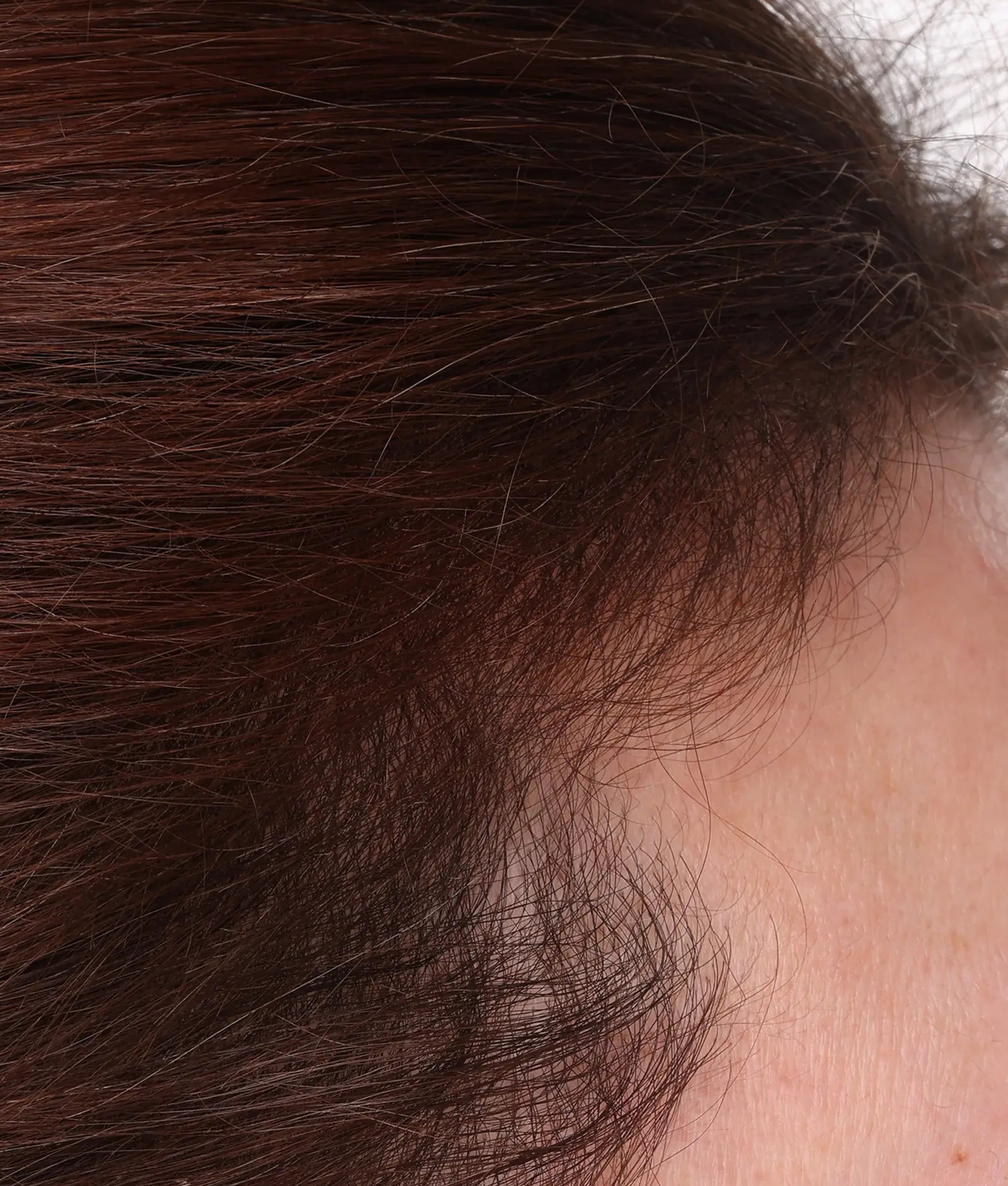 Close-up of scalp with dark brown hair strands and visible hairline