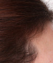Close-up of scalp with dark brown hair strands and visible hairline