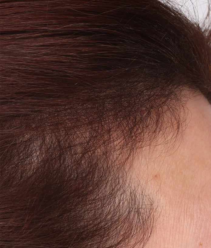 Close-up of scalp and dark brown hair texture along the hairline