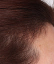 Close-up of scalp and dark brown hair texture along the hairline